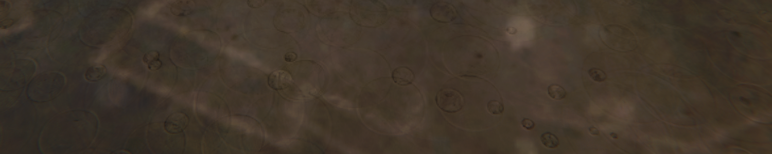 Light ripples in water.