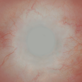 An eye shader sclera map.
